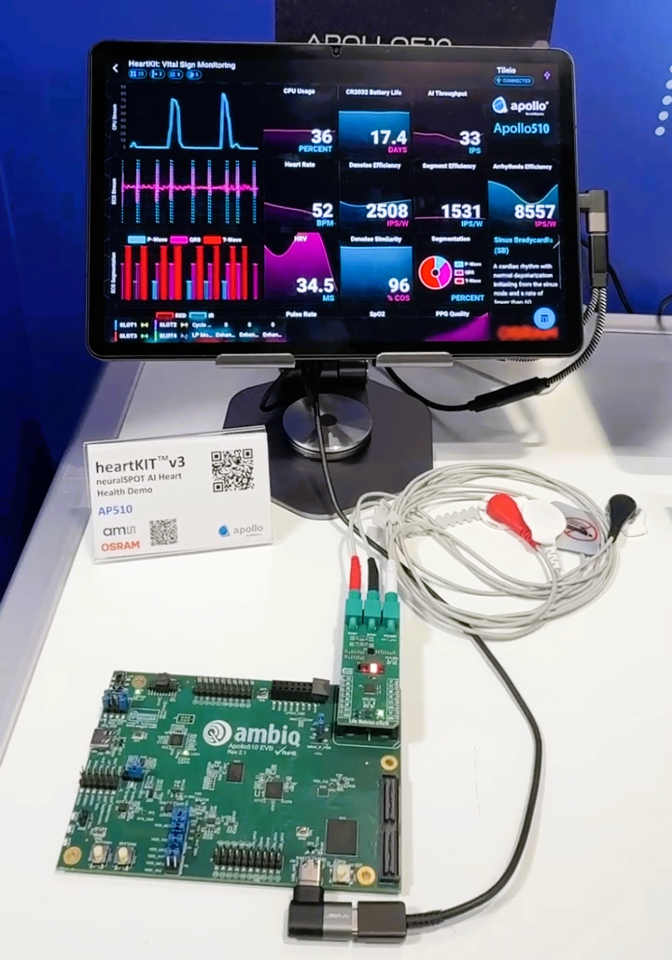 heartKIT v3 neuralSPOT AI Heart Health Demo arm OSRAM Apollo510